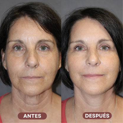 PROMO 2x1 | SERUM ANTIOXIDANTE : REDUCE ARRUGAS Y LINEAS DE EXPRESIÓN